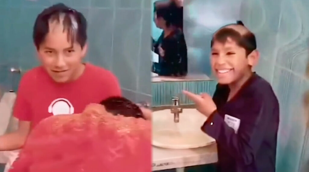 Niños usan crema para depilar como shampoo y se llevan una sorpresa