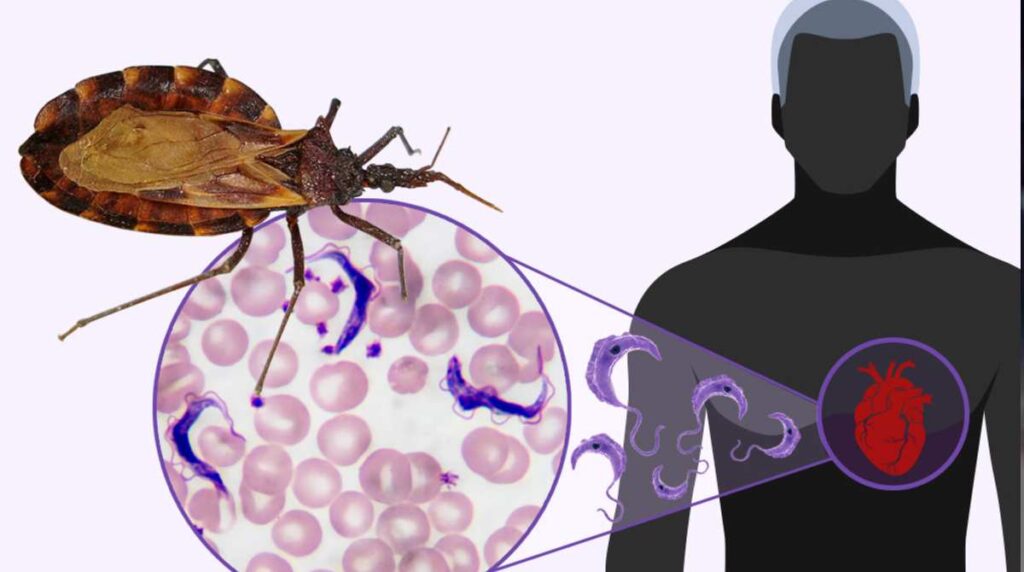 que-es-enfermedad-de-chagas