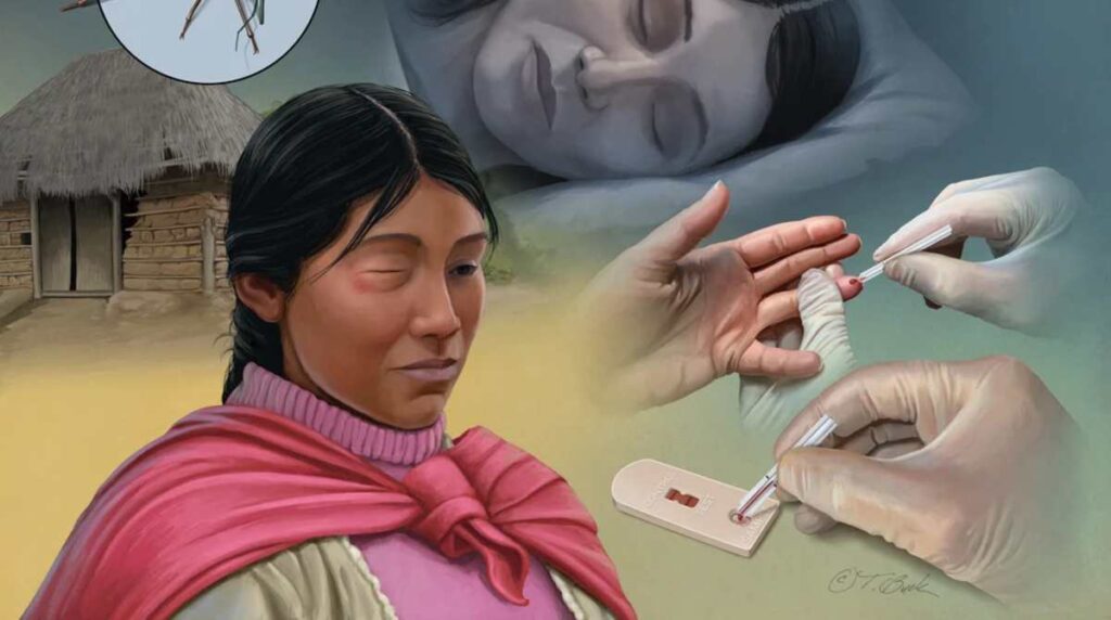 sintomas-enfermedad-chagas